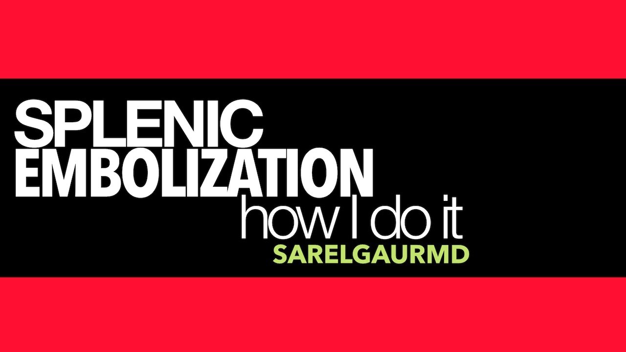 Splenic Embolization: How I Do it