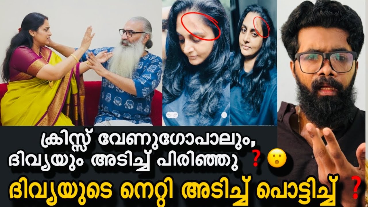 Divya sreedhar, Kriss Venugopal അടിച്ച് പിരിഞ്ഞു ❓ദിവ്യയുടെ നെറ്റിയിലെ പാടുകൾ ക്രിസ്സ് അടിച്ചത് ❓😲