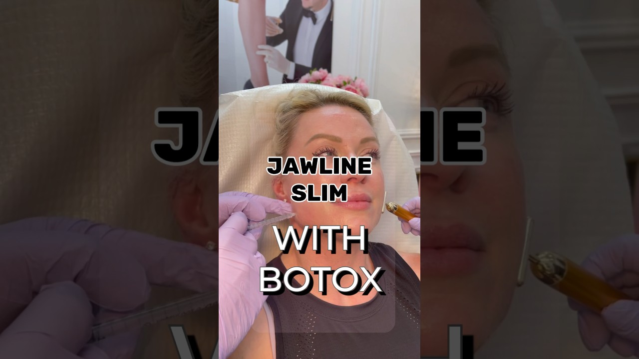 Get a slim jawline with Botox! #botox #jawline #face #medspa #filler #aesthetics #antiaging #trend