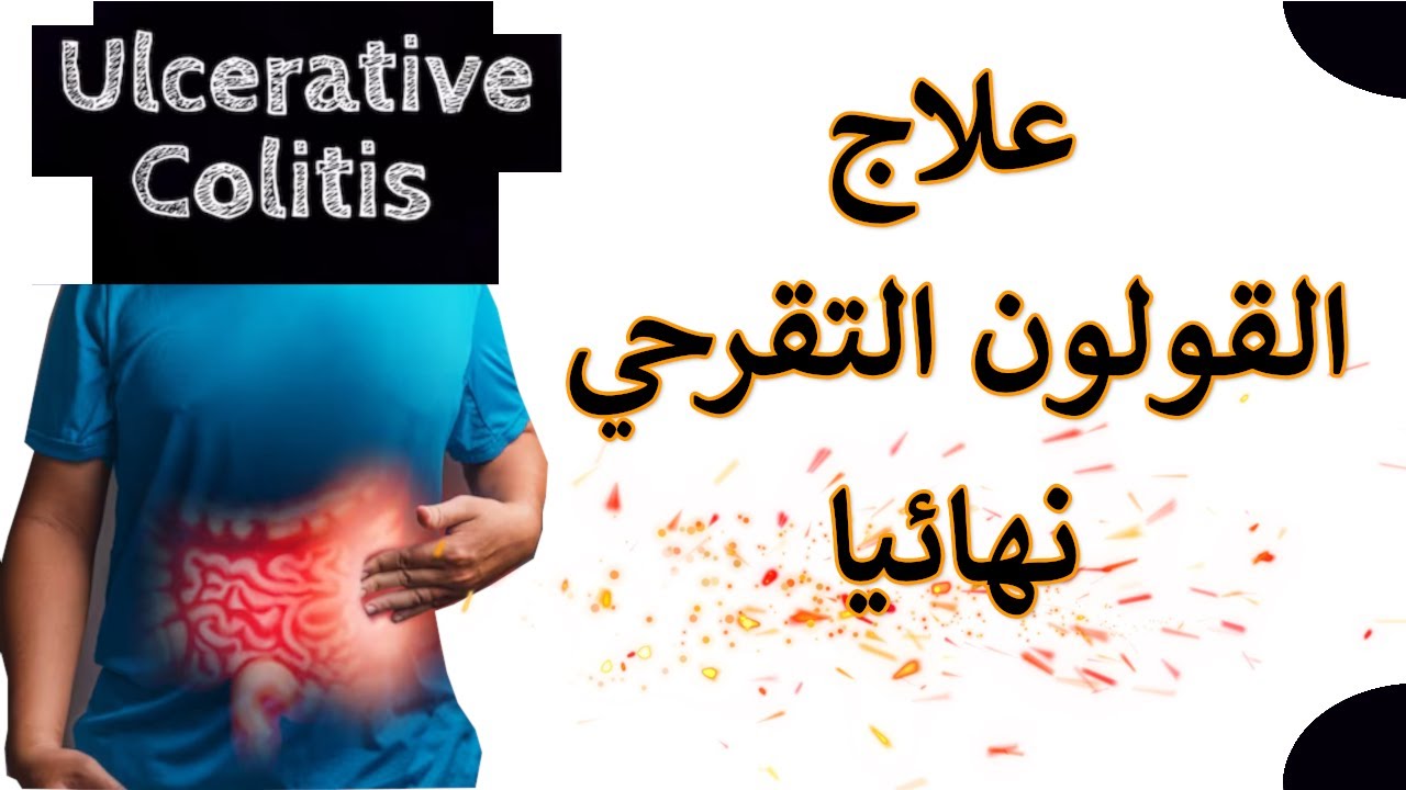 القولون التقرحي وأعراضه| افضل دواء لعلاج القولون| علاج القولون نهائيا| القولون التقرحي المزمن وعلاجه