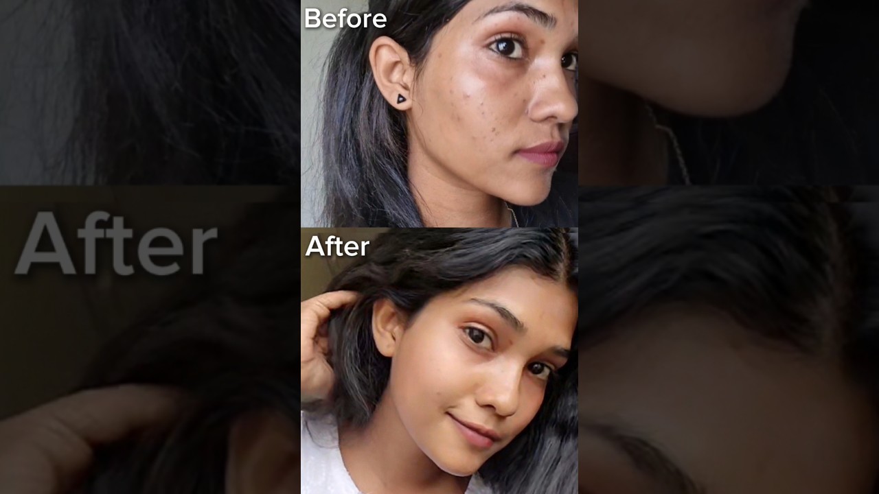 15 days clear skin challenge 😍order now on what'sapp 8089957159#skincare#ftune#ftunecream