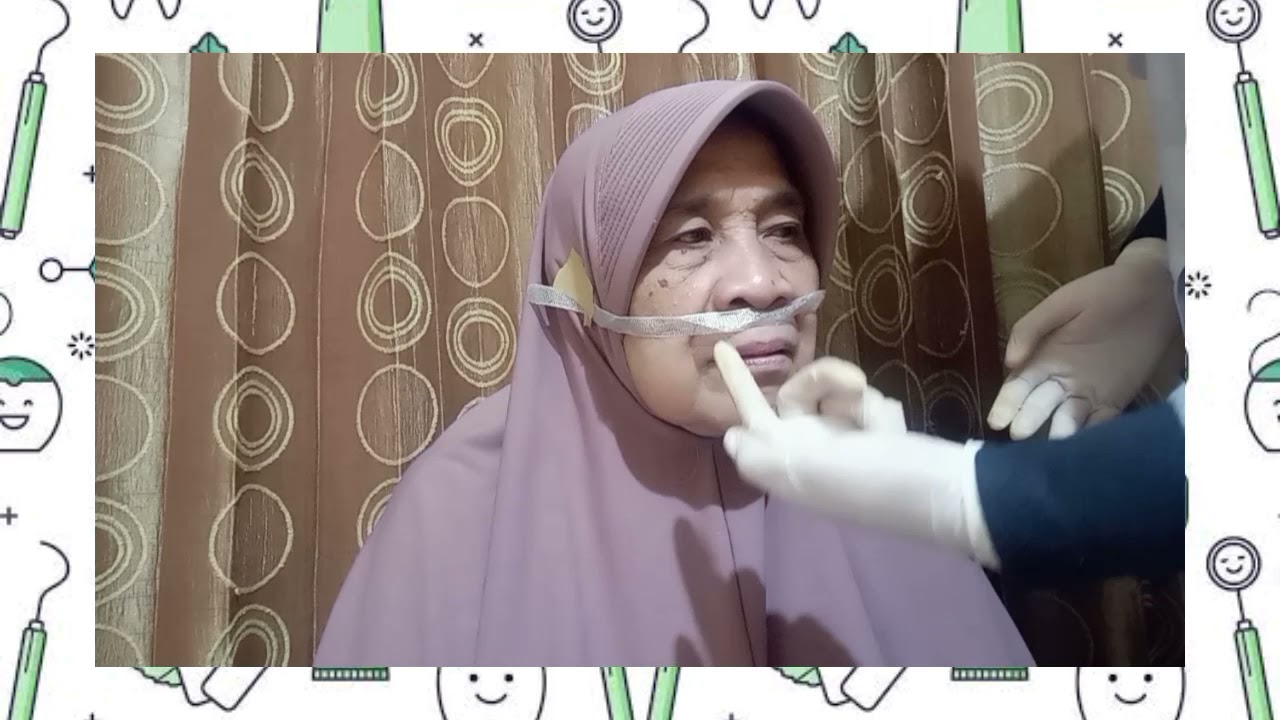 Tahapan Penetapan Gigit Gigi Tiruan Lengkap (GTL)