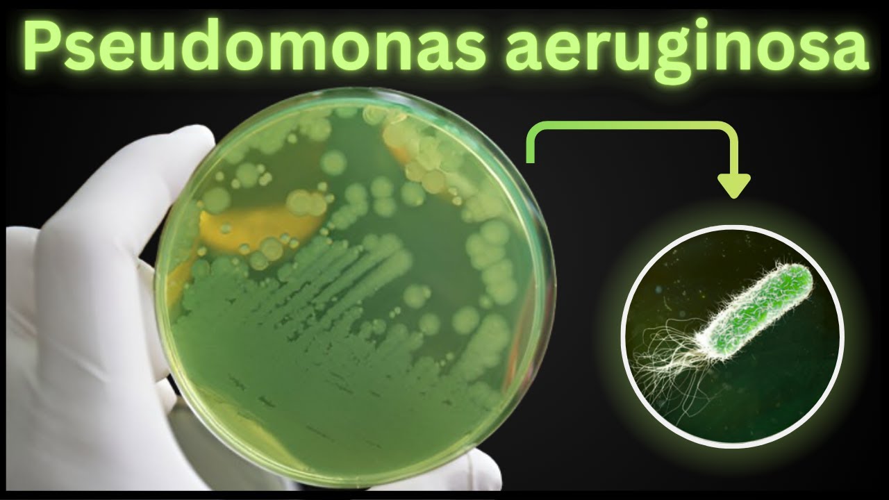 Pseudomonas aeruginosa Explained: Symptoms, Diagnosis, Treatment & Industrial Uses