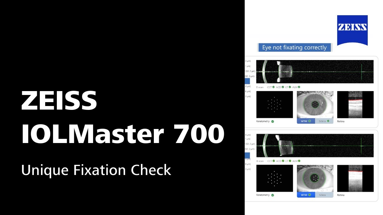 ZEISS IOLMaster 700 - Unique Fixation Check