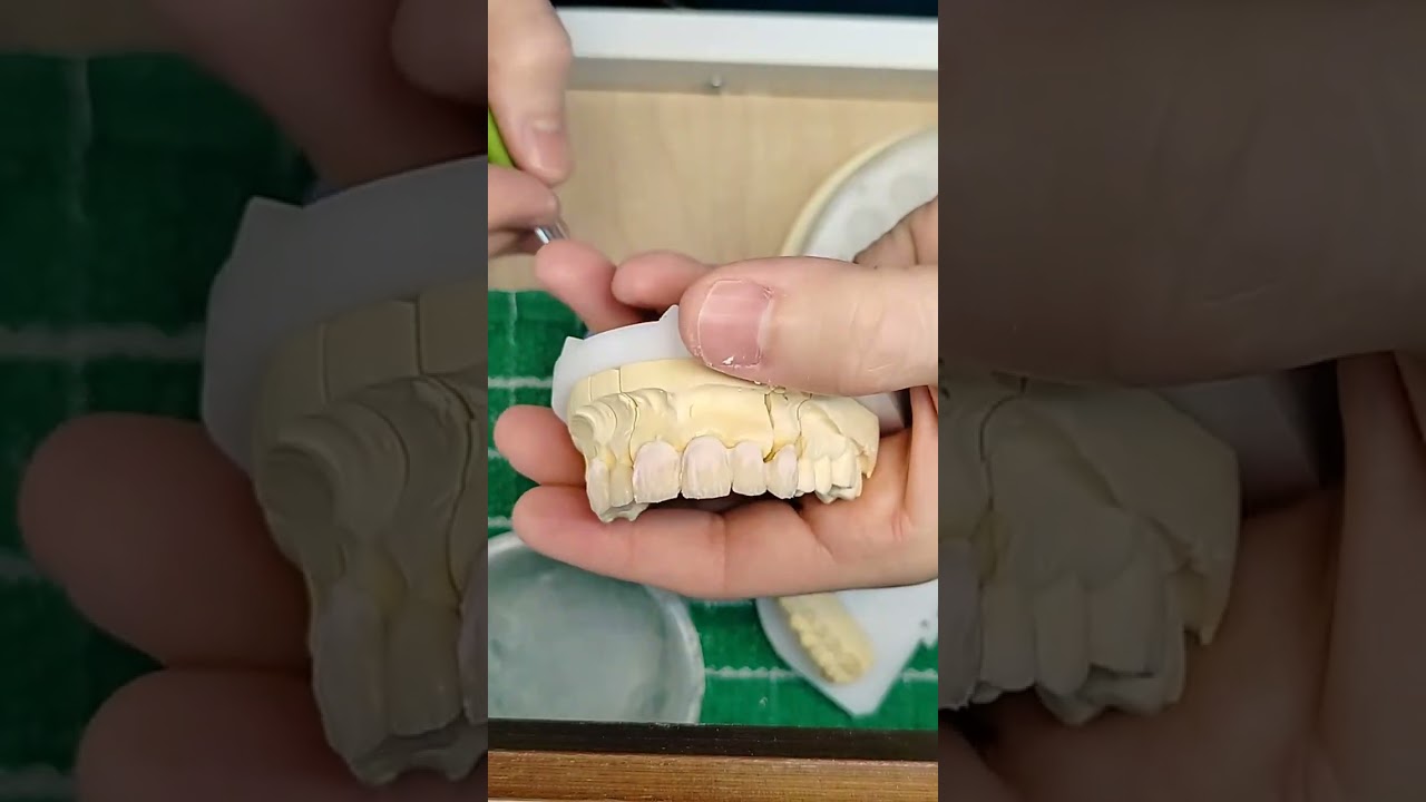 Ceramic Buildup Second Layering
