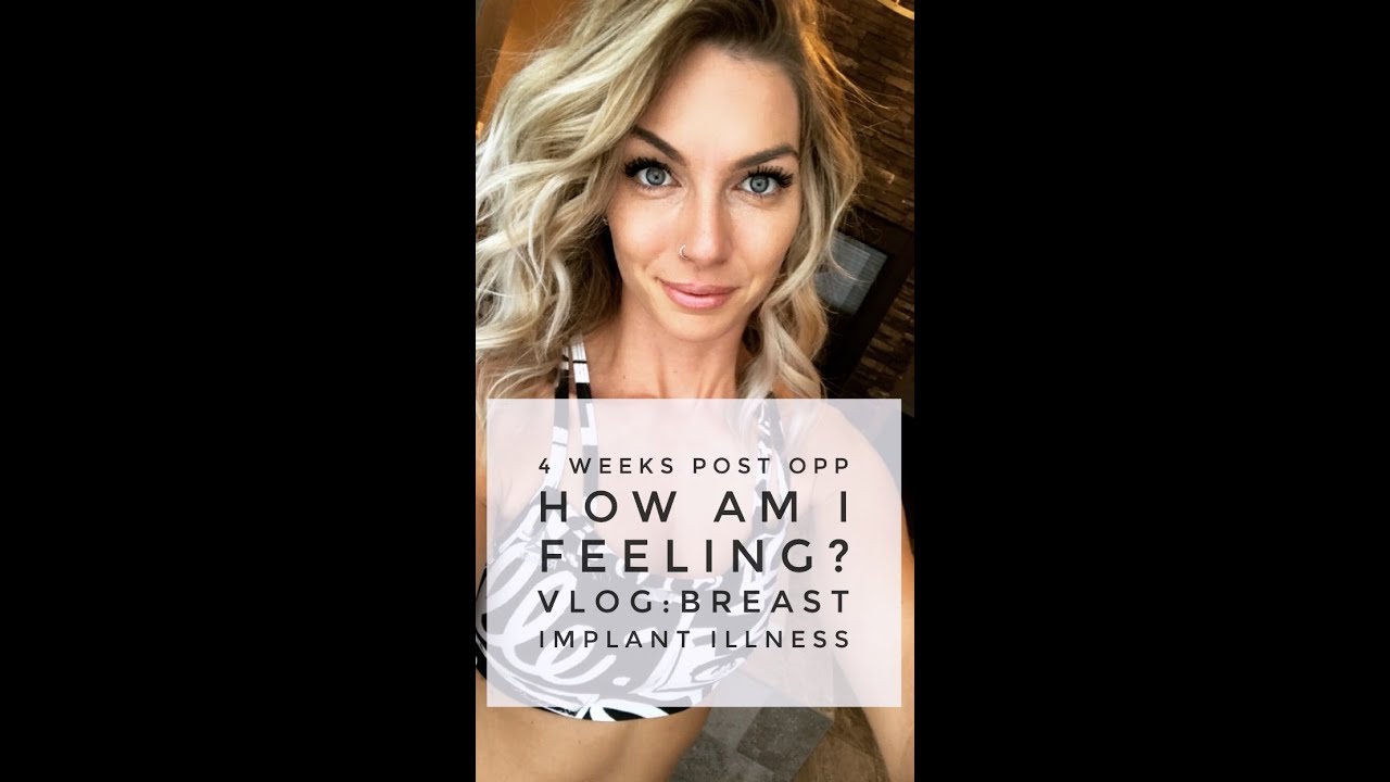 4 WEEKS POST EXPLANT/Breast implant illness VLOG/ How im feeling