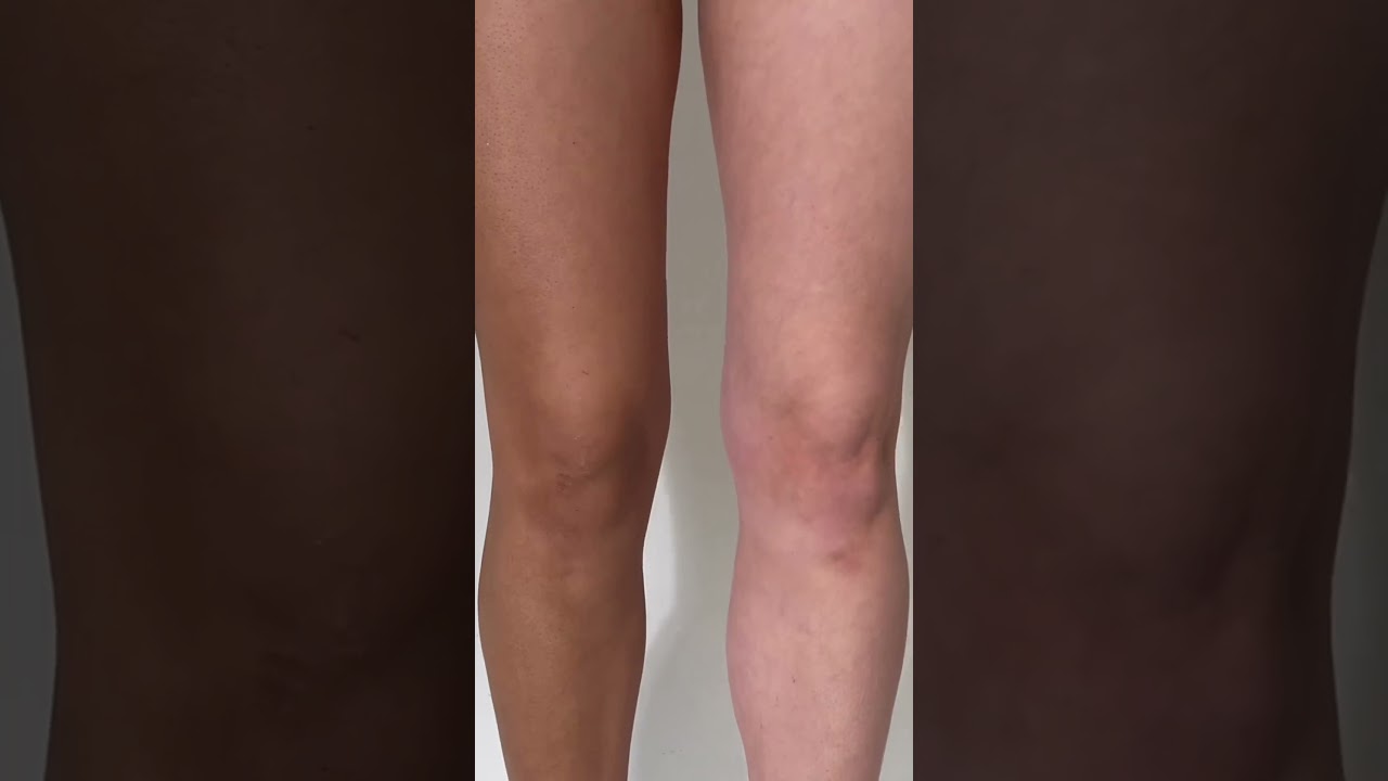 The darkest Ultra Dark Self Tan | Bali Body #shorts