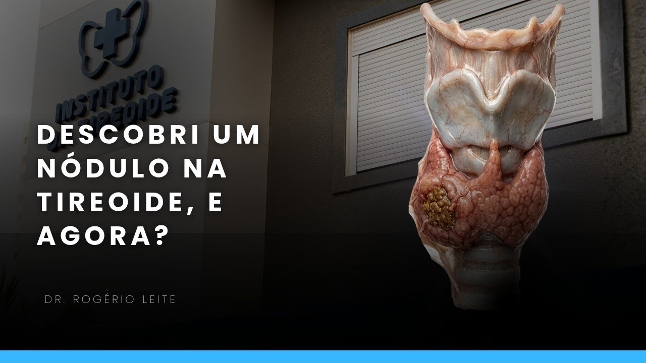 Descobri um nódulo de tireoide e agora? 