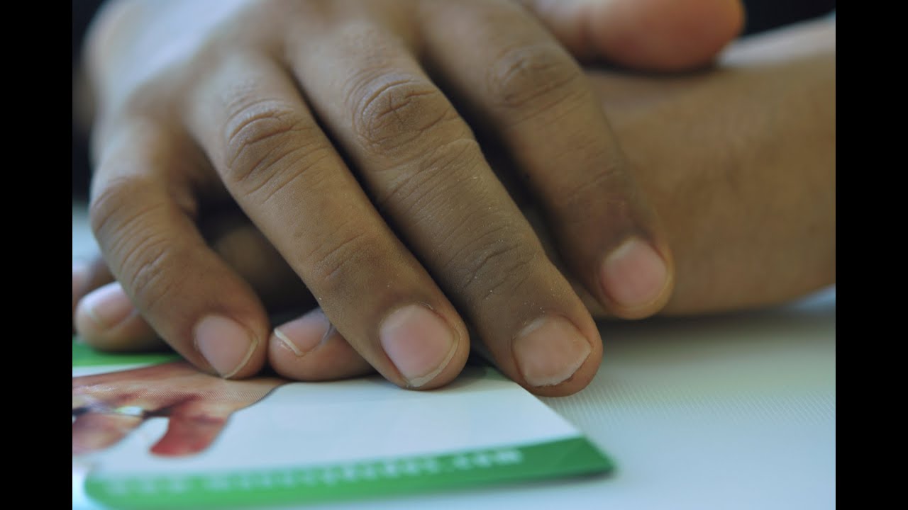 Prótesis para dedo, (finger prosthesis) No  104