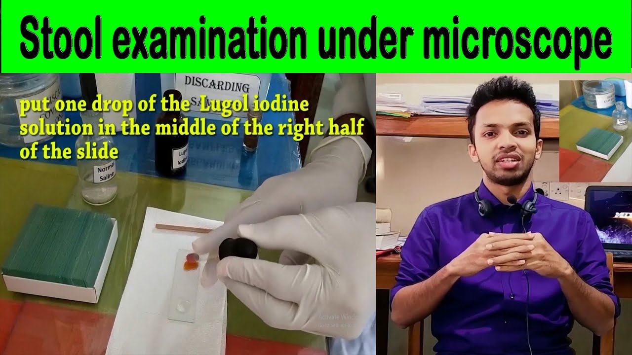 Stool examination under microscope | test procedure | eggs & cyst identification