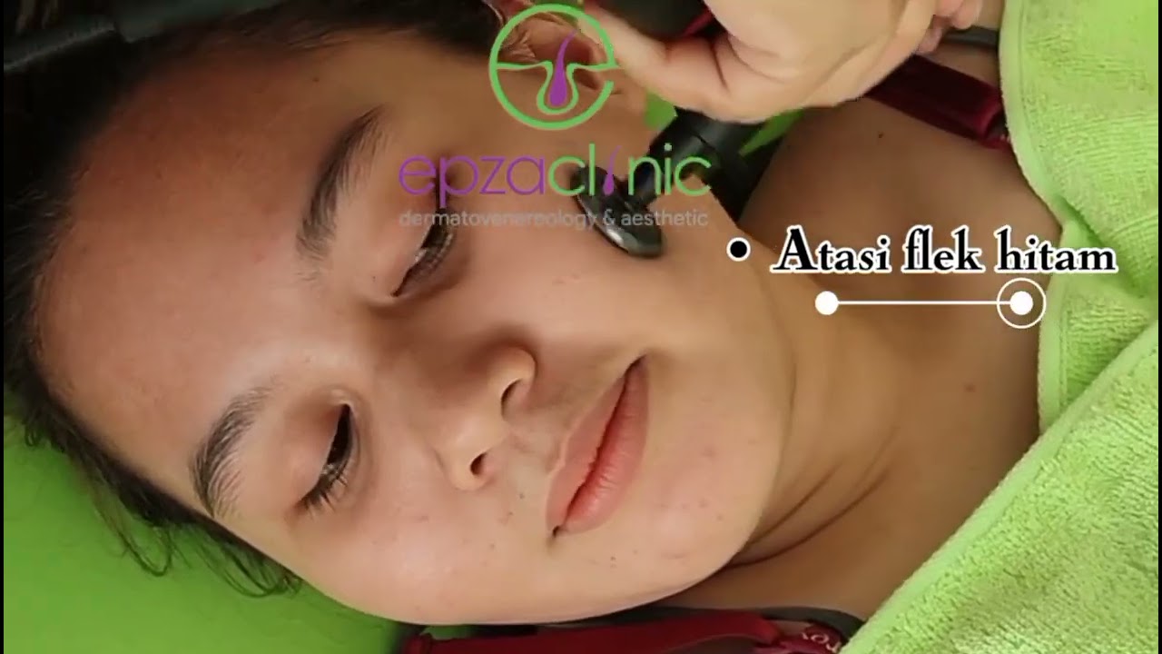 FAST RESPON Telp/WA 0853-2903-6883 Biaya Dokter Kulit Di Pekalongan Epza Clinic