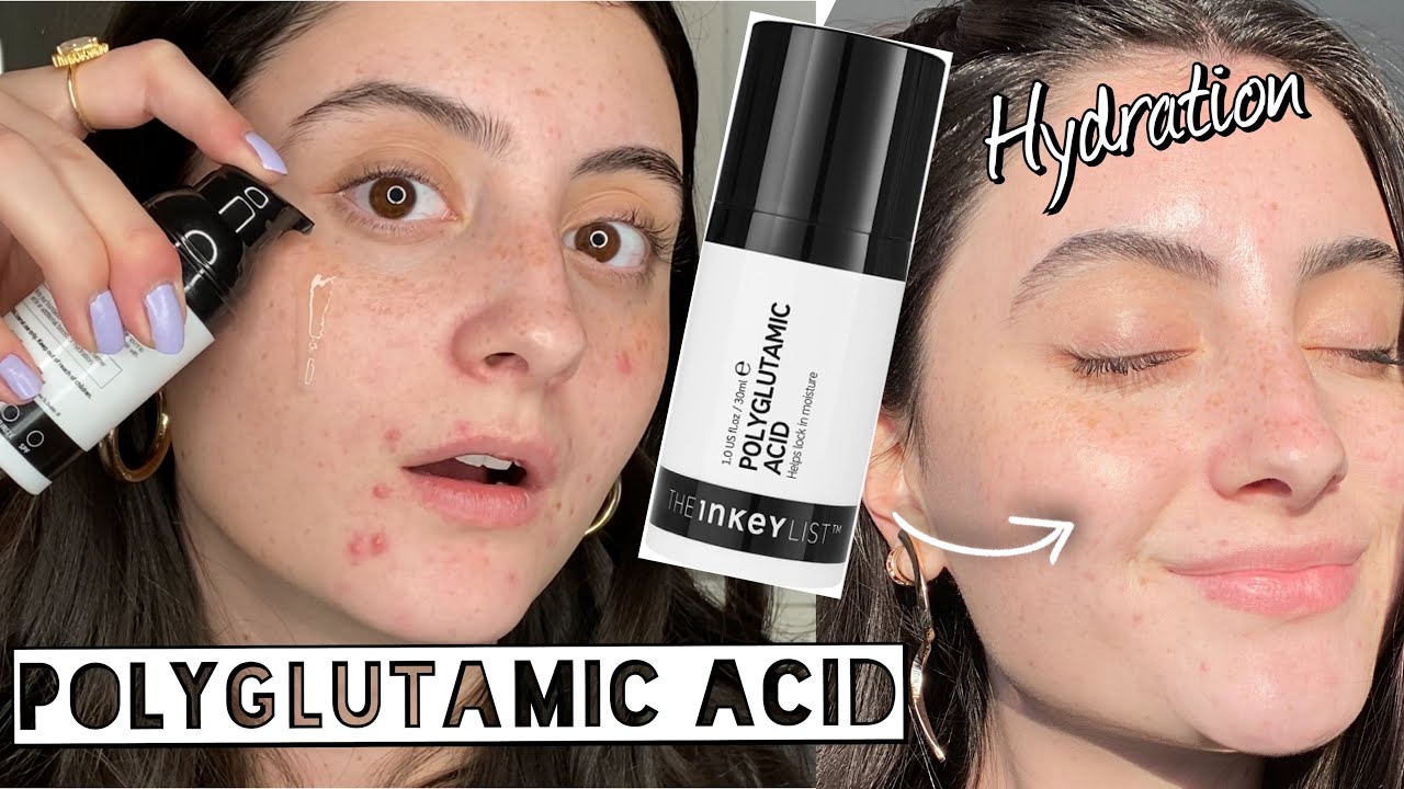 TESTING THE INKEY LIST POLYGLUTAMIC ACID FOR HYDRATION ON DRY, SENSITIVE, ACNE SKIN for 2 WEEKS