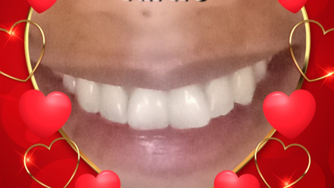 ቅን መሆን ለምን ከበደን ምክንያቱስ ምን ነው 🙆💔🥲