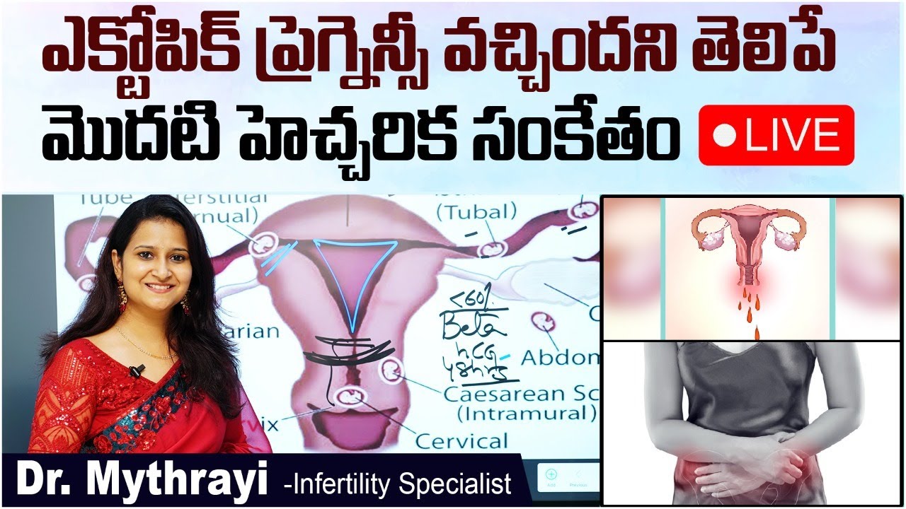 ఎక్టోపిక్ ప్రెగ్నెన్సీ సూచనలు || Ectopic Pregnancy Symptoms in Telugu || Mythri Sri Fertility Centre