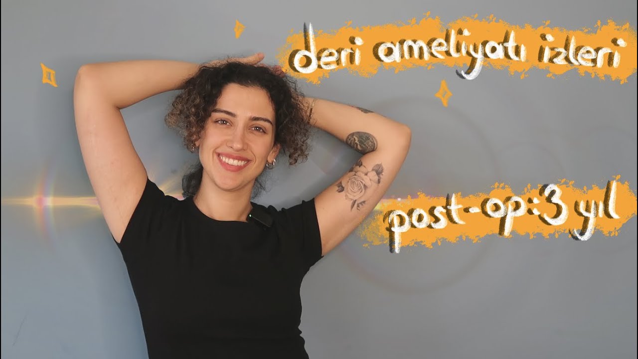 Karın ve Kol Germe Ameliyat İzlerim