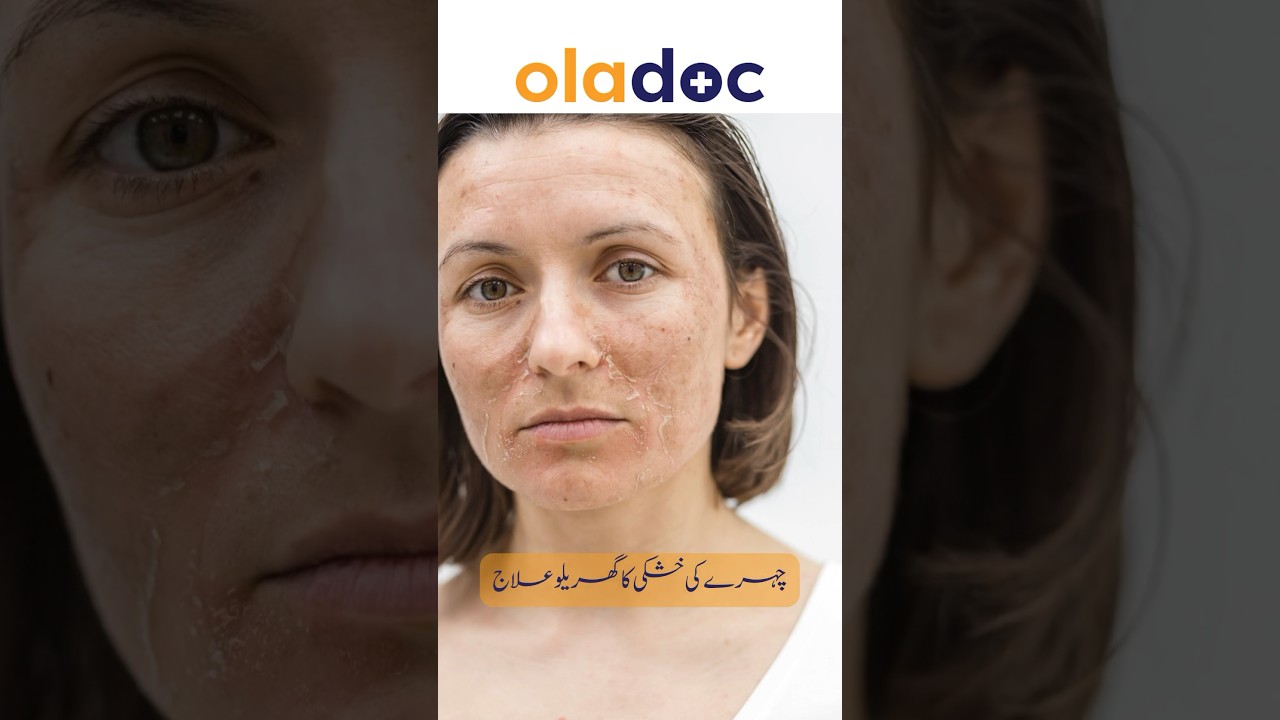 Skin Dryness Causes & Treatment - Chehre Ki Khushki Ka Ilaj #healthtips #shorts #youtubeshorts