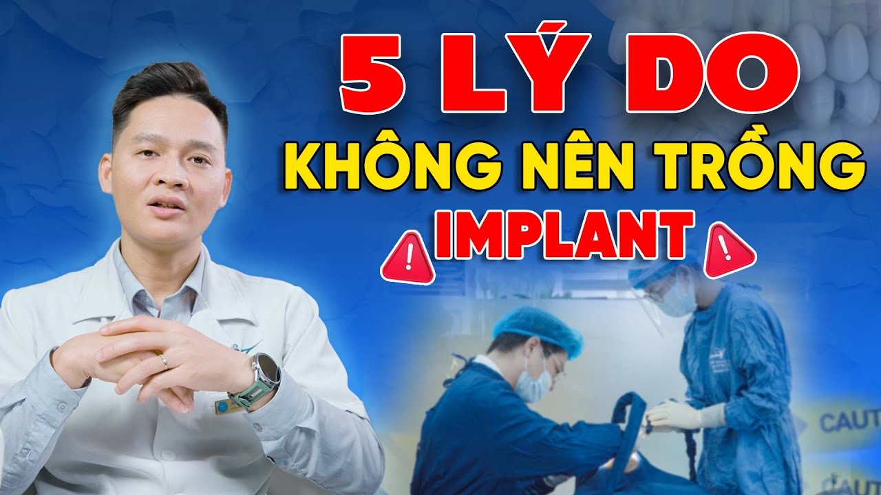 Bạn KHÔNG NÊN trồng implant 5 sự thật quan trọng bạn cần biết