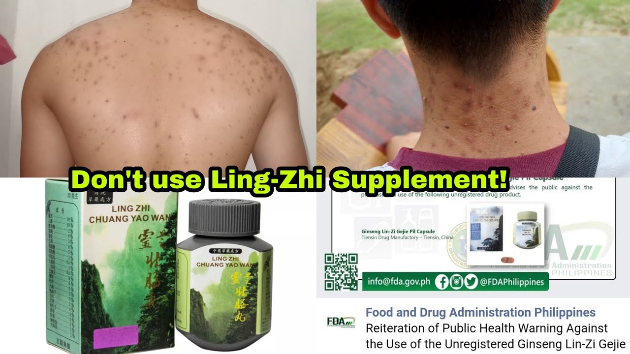 Beware of this Supplement! Ling-Zhi Ginseng, Chuang Yao Wan, Pambataba ng supplement