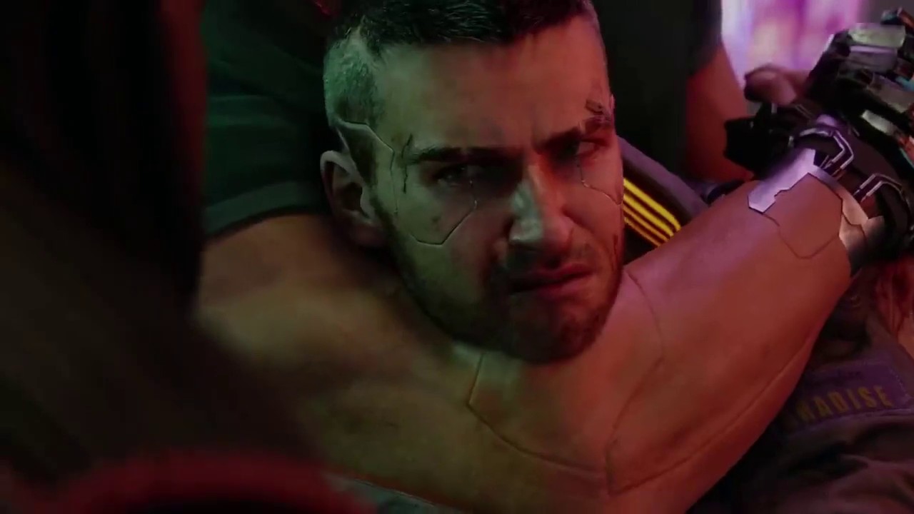 Hyper - FCKD  (Cyberpunk 2077)