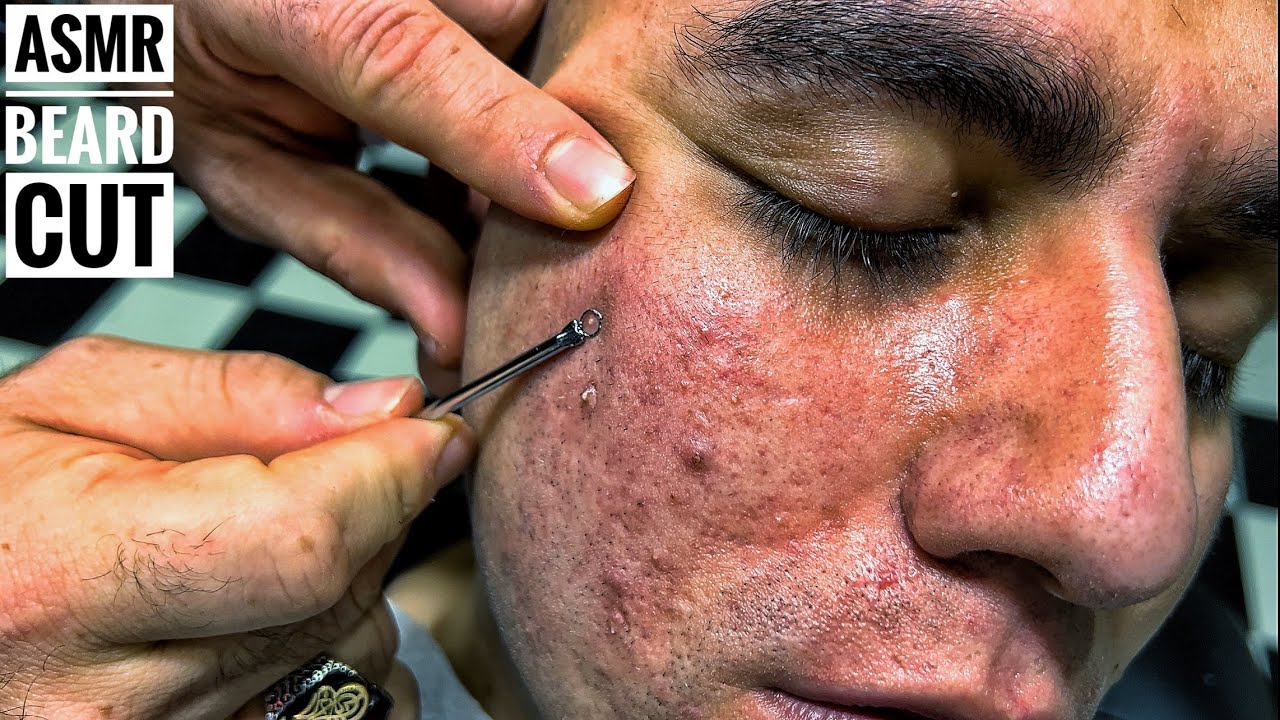 ASMR BEARD CUT • Acne and skin Removal • Barber Massage #asmr