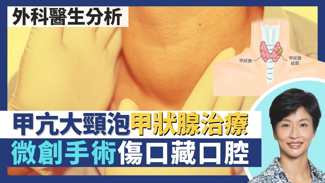 甲亢大頸泡甲狀腺治療｜圖解甲狀腺結節射頻消融術 甲狀腺微創手術傷口藏口腔內！眼凸病人藥物治療後復發不能飲碘水治療需做手術？甲狀腺疾病分功能性vs結構性問題｜王建芳醫生 何柏堅外科醫生｜人類健康研究所