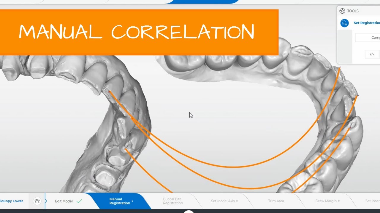 CEREC - How to: Manually correlate scans