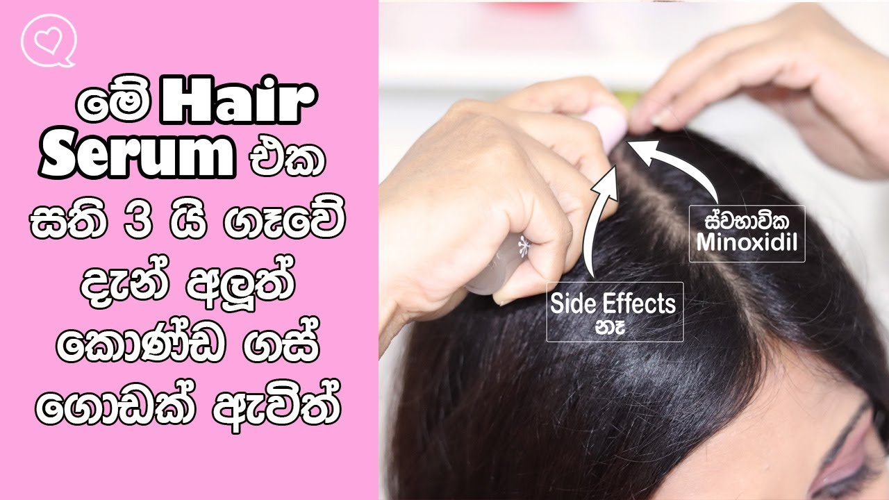 Apply This Natural Minoxidil Hair Serum For Hair Growth | DIY Hair Serum