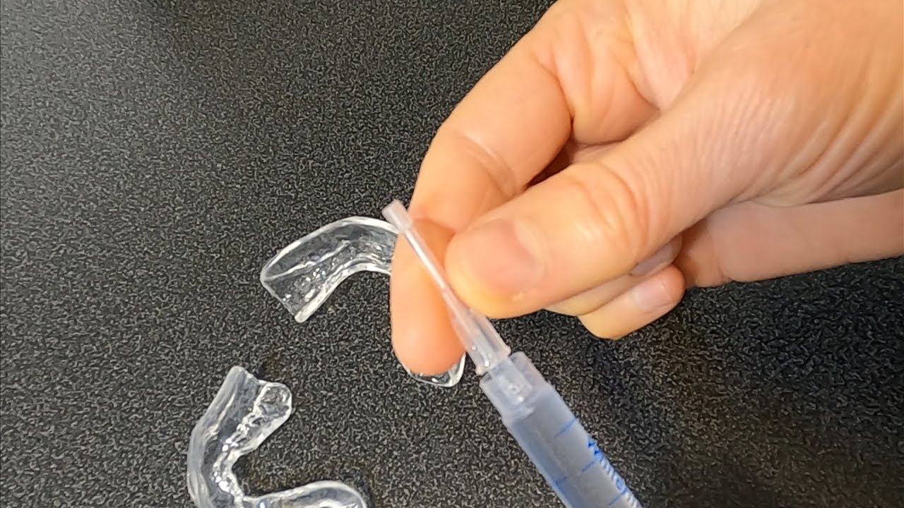 Home Kit Teeth Whitening | How To Whiten Your Teeth At Home