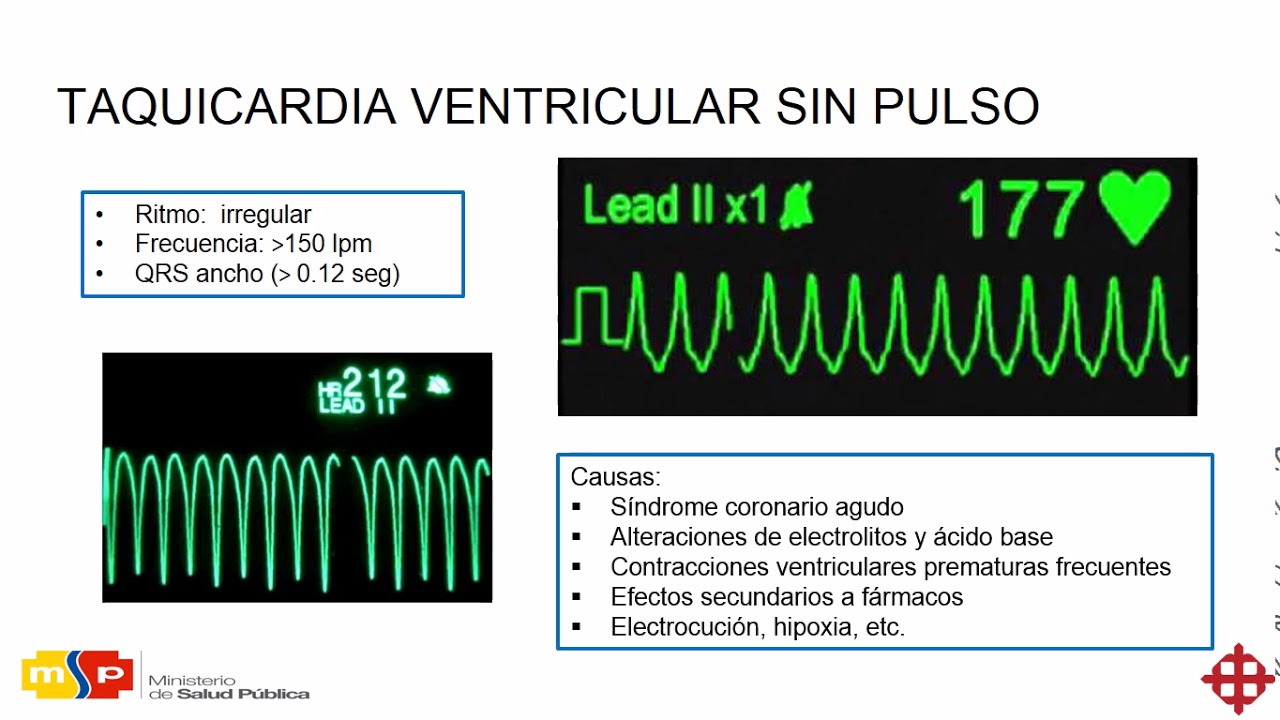 Clase 5 APH Ritmos de paro cardiaco