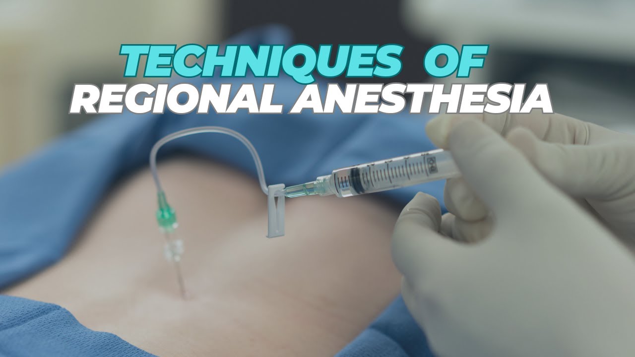 Regional Anesthesia | Techniques