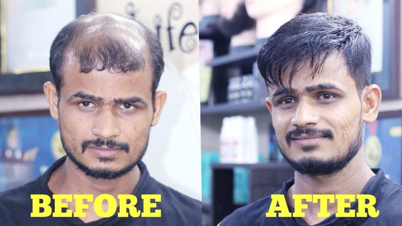 best hair patch [wig] video in india stylish hair cut by master RIZY 9582581323