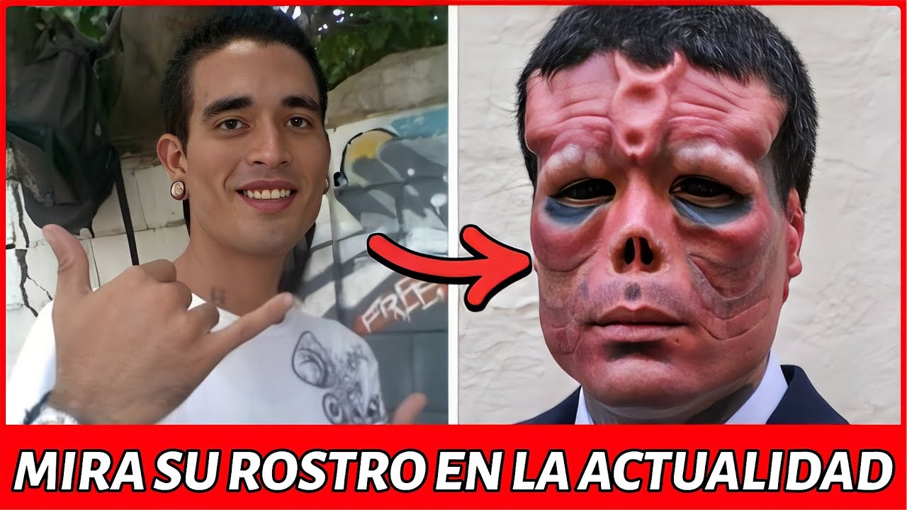 MIRA ESTAS 15 TRANSFORMACIONES F&iacute;sicas de famosos Venezolanos !