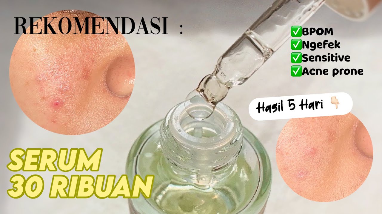 Serum 30 Ribuan Terbaik (acne prone skin)