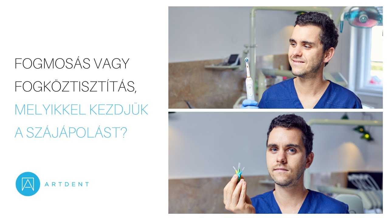 Fogmosás vagy fogköztisztítás, melyikkel kezdjük a szájápolást?