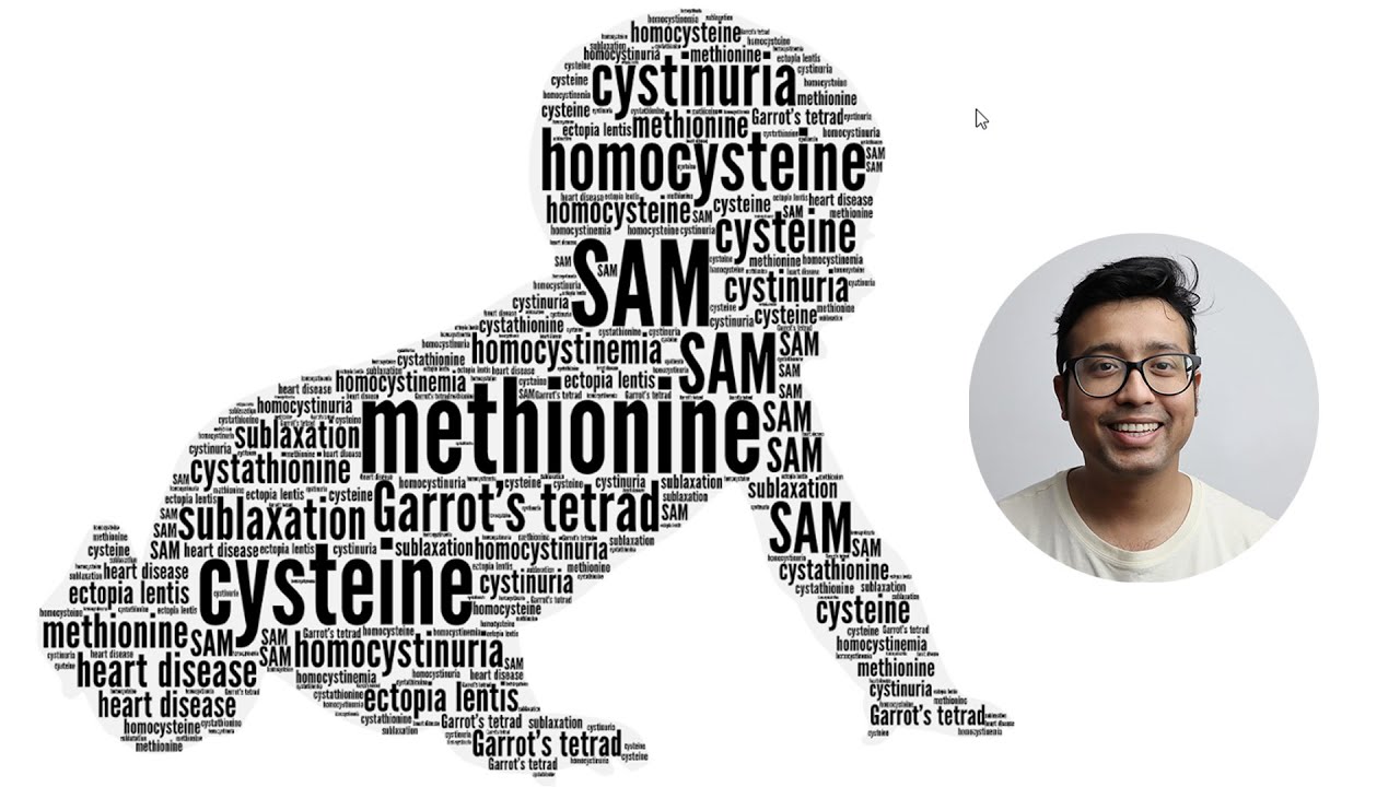 Metabolism of Sulfur Containing Amino Acids and Inborn error of Methionine and Cysteine Metabolism.