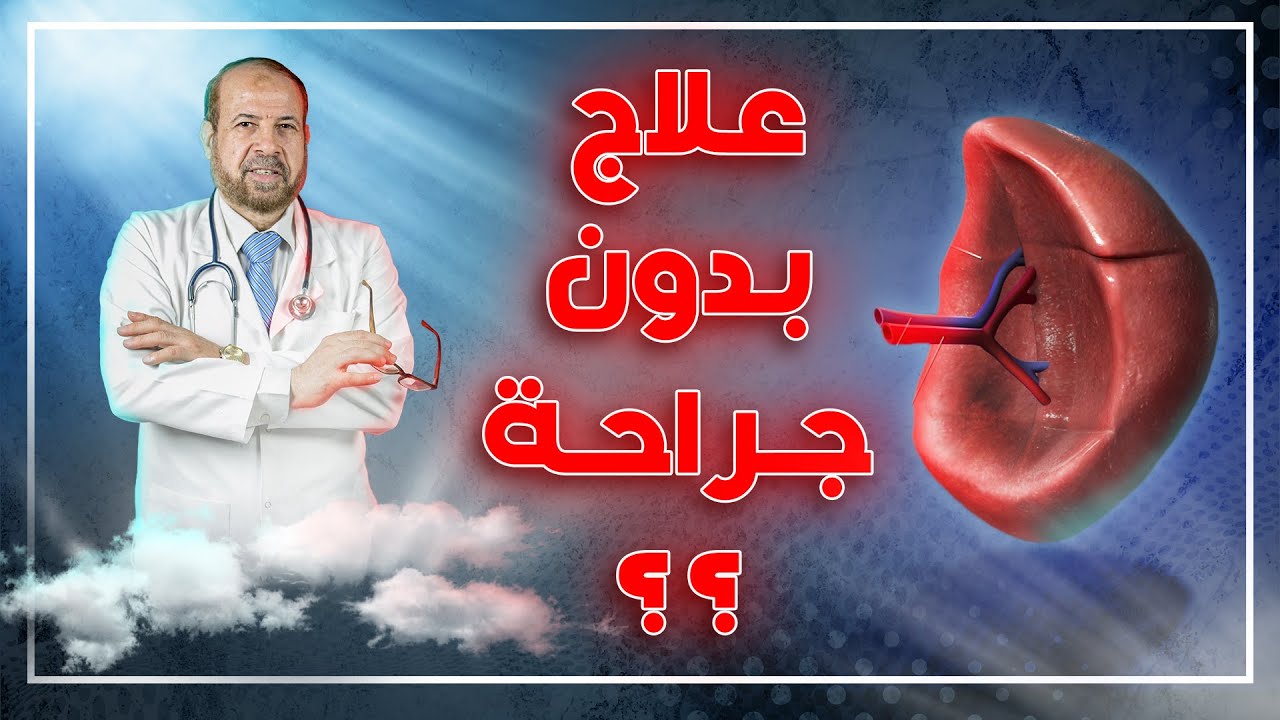 علاج تضخم الطحال والثلاسيميا بدون جراحة