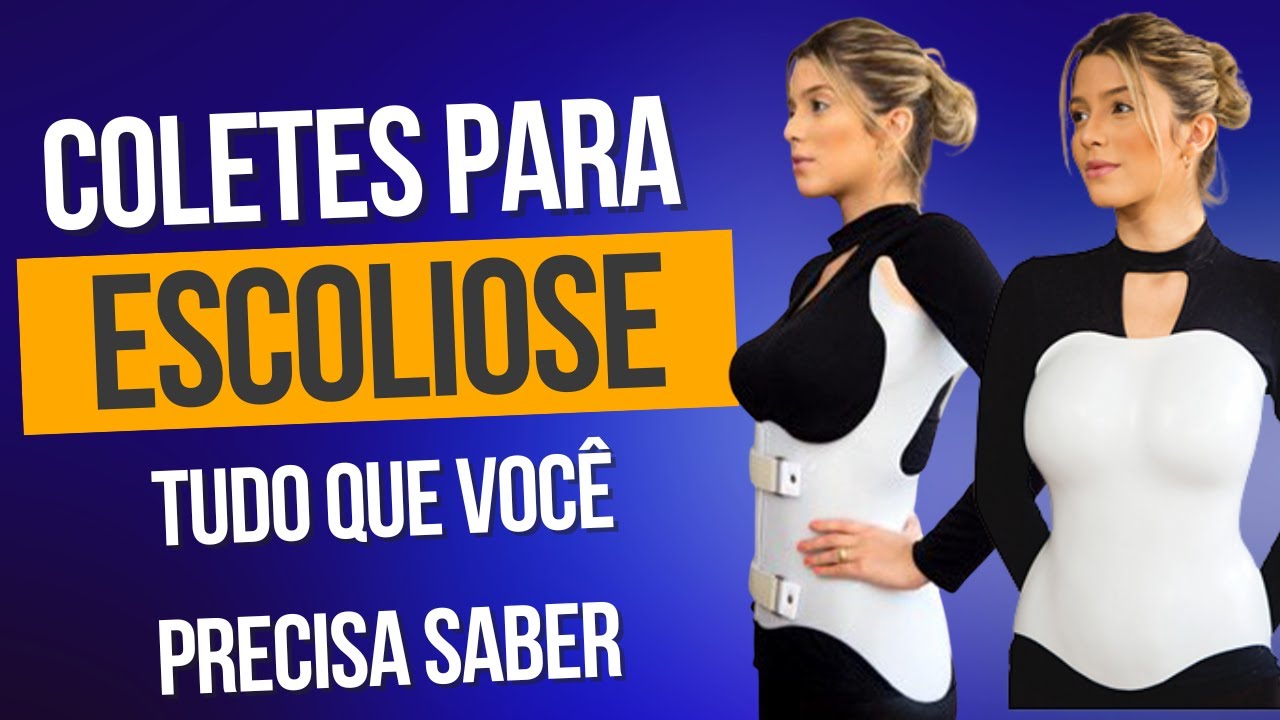 Tipos de Colete para Tratamento de Escoliose do Adolescnete - Milwaukee, Boston, 3D