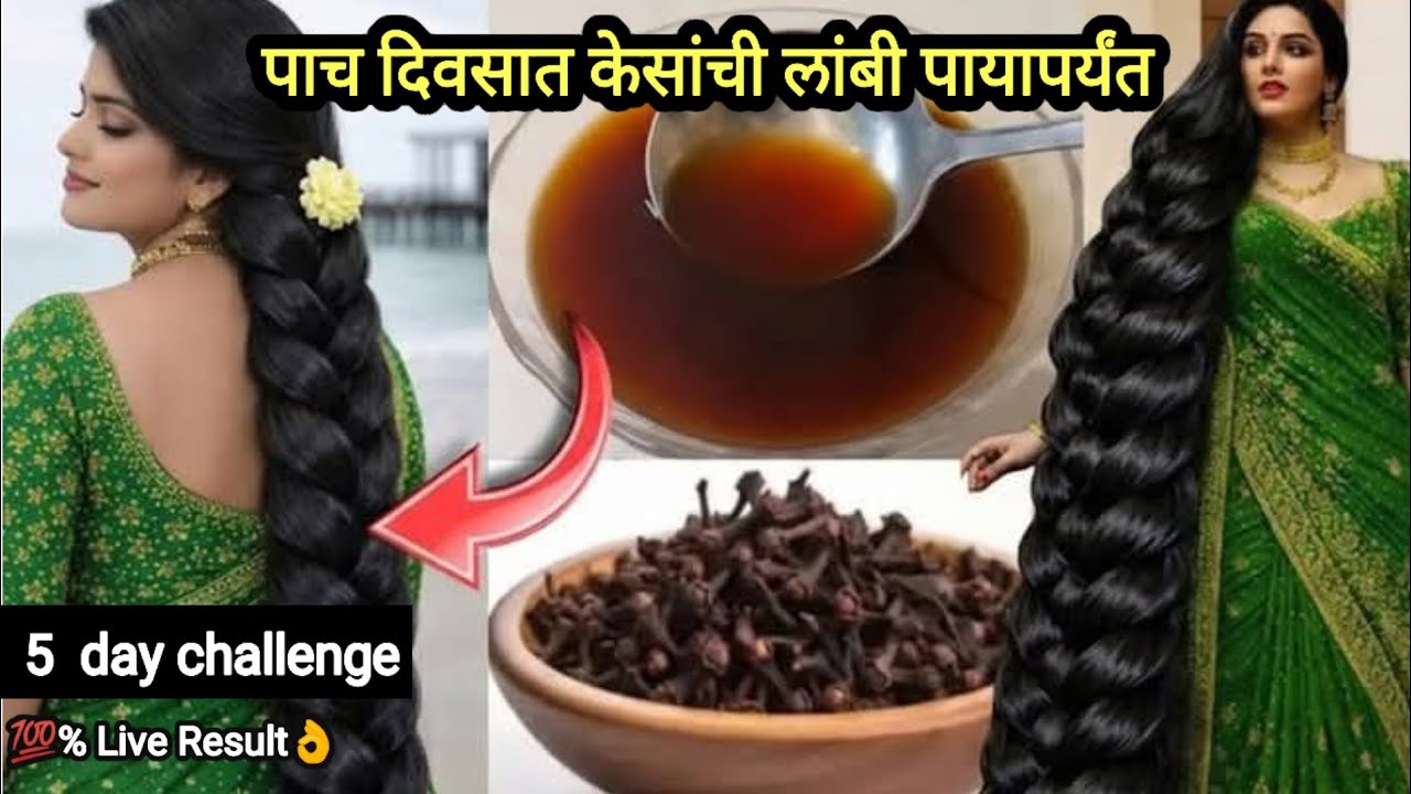 लवंग मध्ये फक्त एक वस्तू मिसळा केस इतके लांब दाट होणार की सगळे पहातच राहणार💯✅ Hair Booster tonic👌