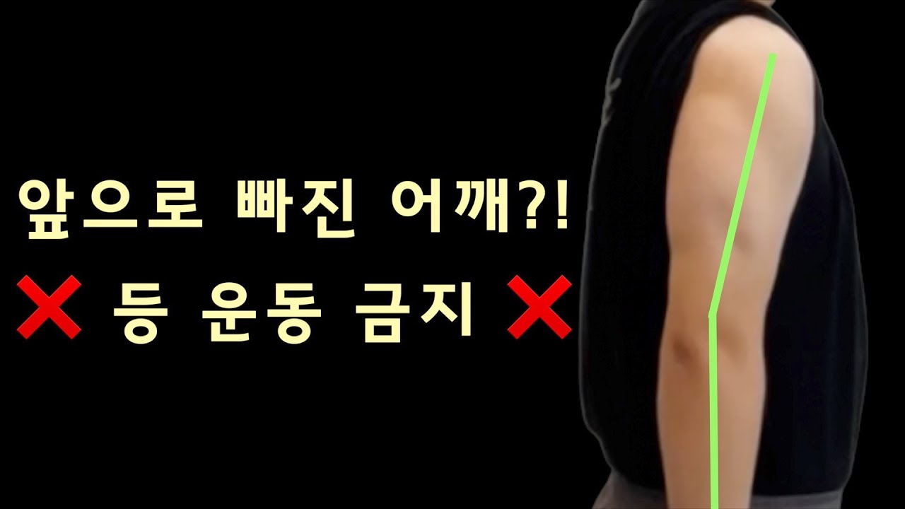 굽은 어깨, 라운드 숄더처럼 보이나요⁉️  절대 아닙니다 ‼️ 상완골 전방활주
