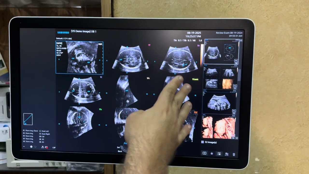 5D CNS حقيقة التصوير الخماسي الابعاد ..
