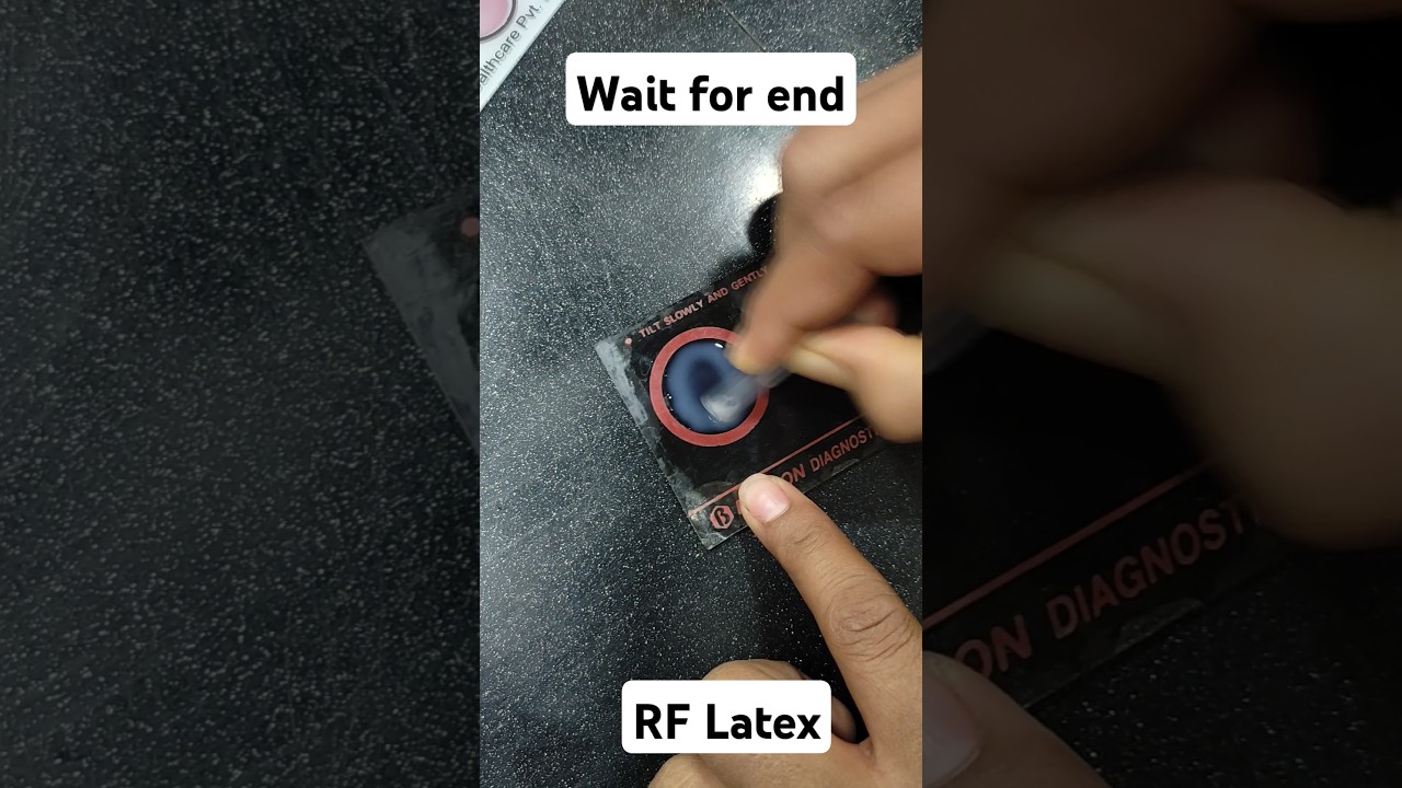 RF Latex || slide agglutination method.... 😳 #medicaltest #shorts #paithology #bloodprofile
