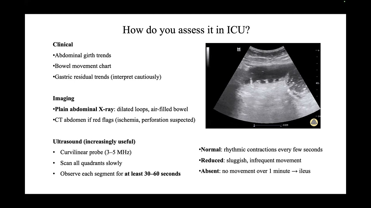 Gut dysmotility