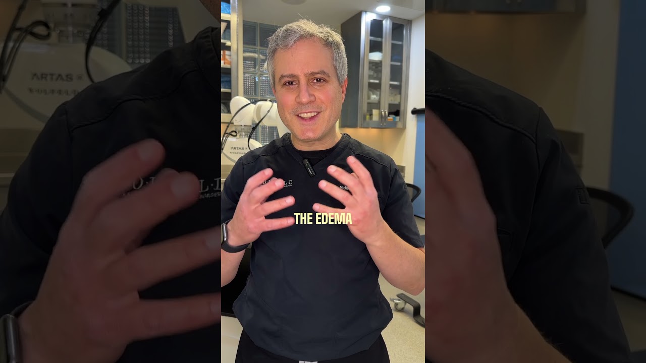 3 Things to Know After a Hair Transplant | Dr. Wolfeld Shares His Tips