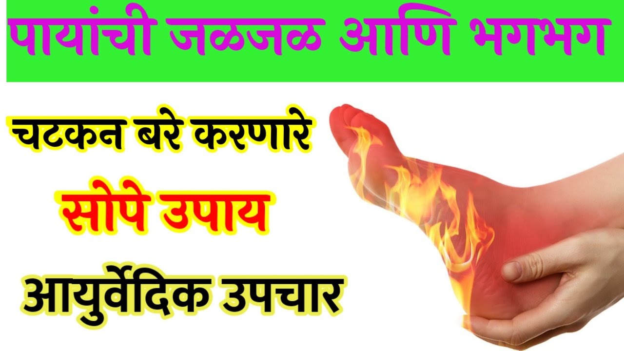 पायांची जळजळ भगभग आग कमी करा । सोपे घरगुती उपाय आयुर्वेदिक उपचार । पायांची जळजळ होणे ।
