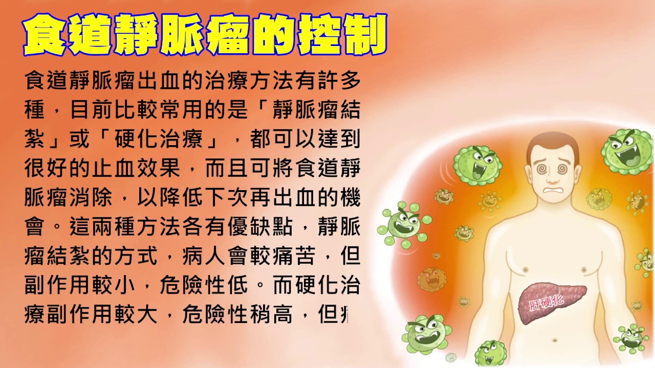 【肝病知識百科】肝硬化4-3：肝硬化的治療