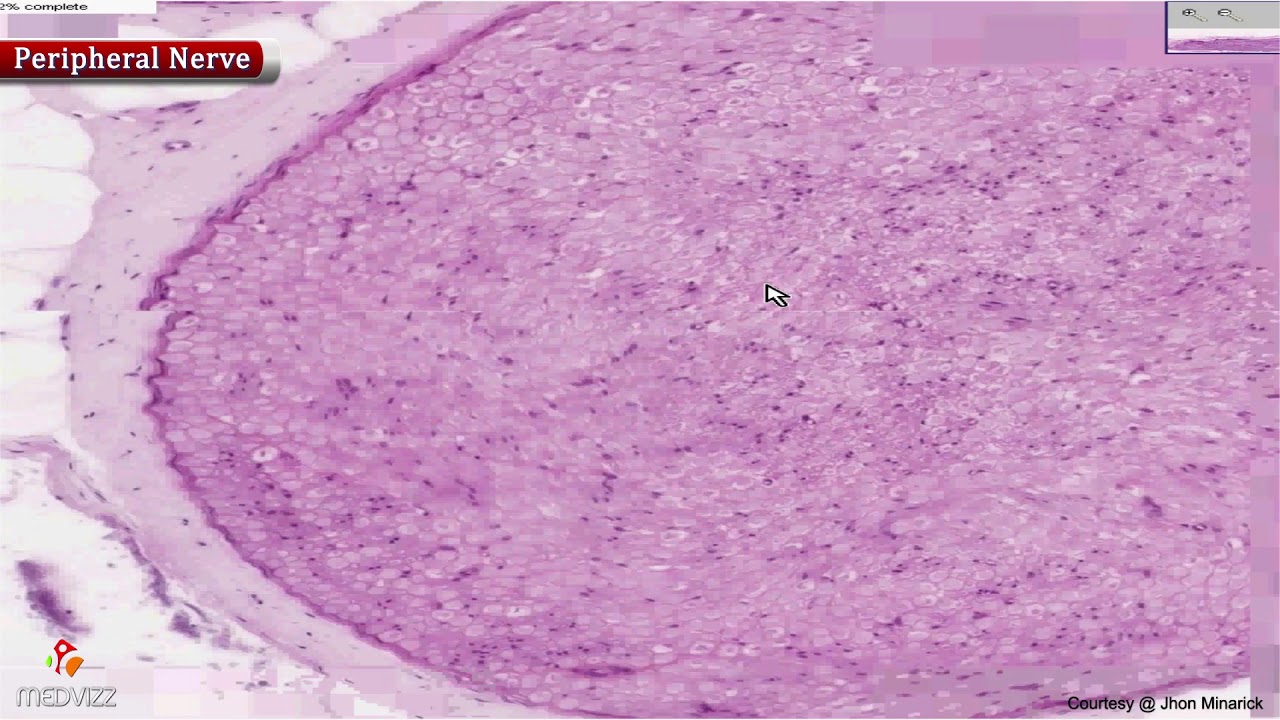 Histology of peripheral nerve - Shotgun Histology