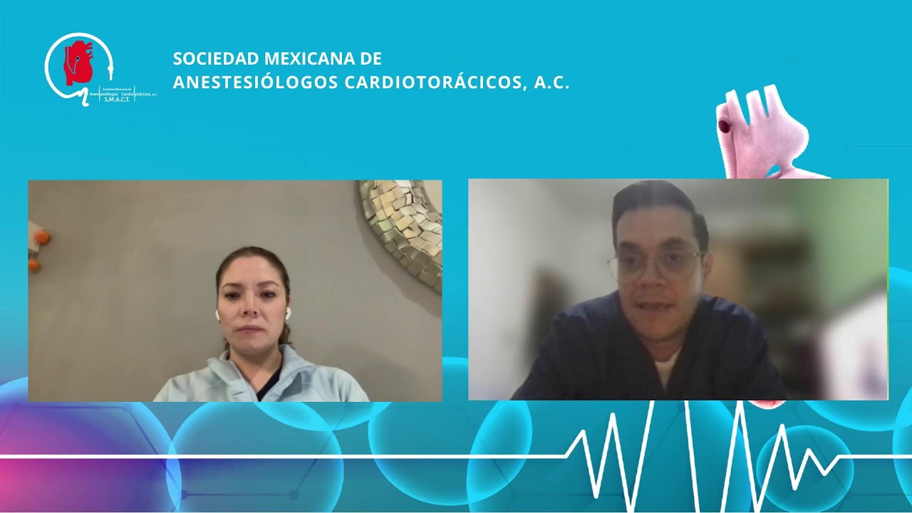 Webinar SMACT