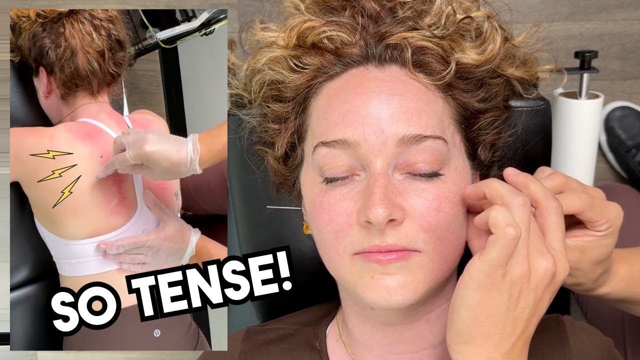 Google Led Her Astray...Here’s What’s ACTUALLY Causing Her Pain - Treatment, Cracks & Acupuncture