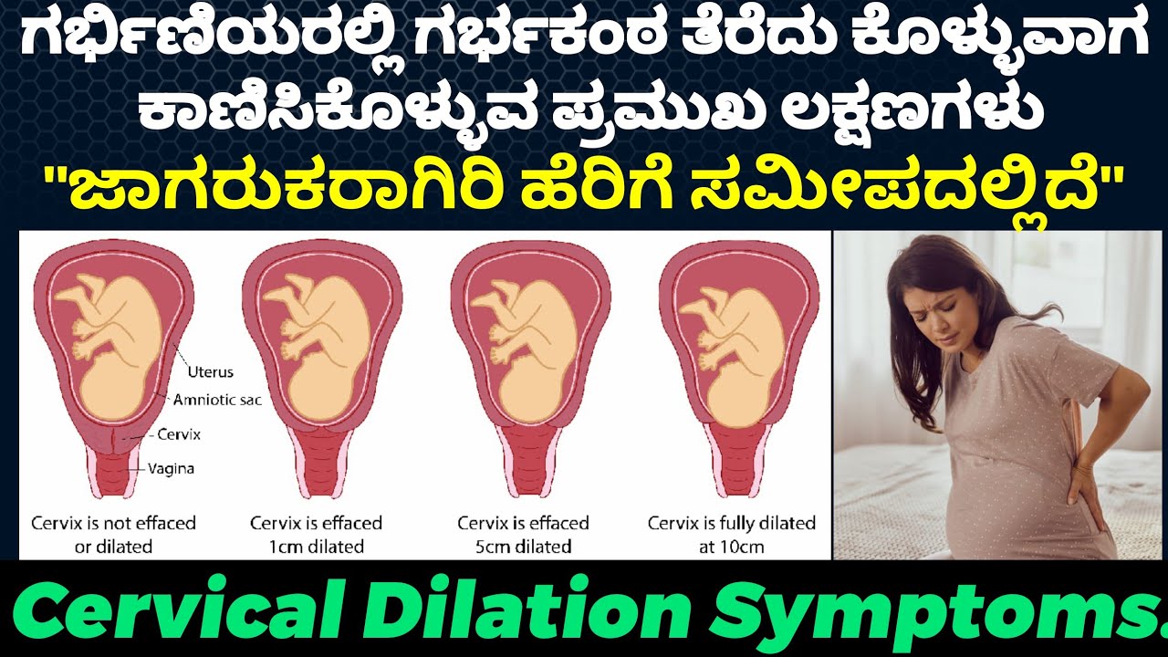 Cervix Dilation Symptoms | ಗರ್ಭಿಣಿಯರಲ್ಲಿ ಗರ್ಭಕಂಠ ತೆರೆದು ಕೊಳ್ಳುವಾಗ ಕಾಣಿಸಿಕೊಳ್ಳುವ ಪ್ರಮುಖ ಲಕ್ಷಣಗಳು