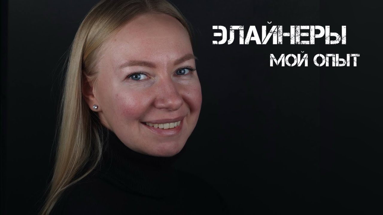 Элайнеры. Мой успешный опыт 